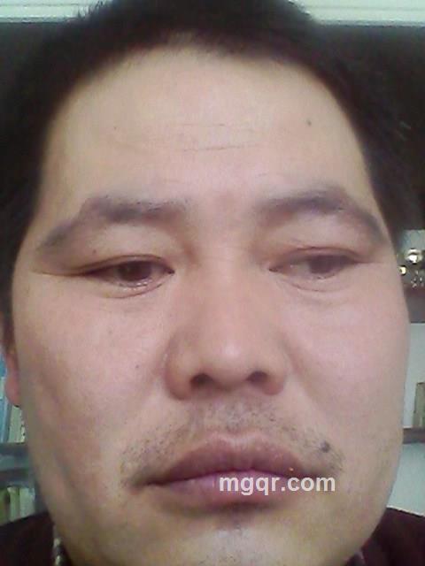 飞飞发病的头像