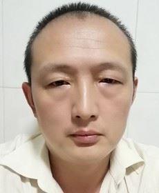 单叶蜻蜓的头像