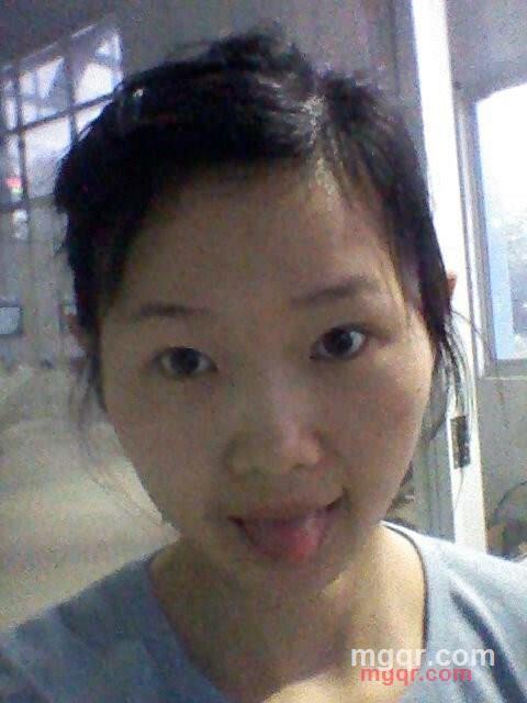 吃虾会过敏的第2张照片