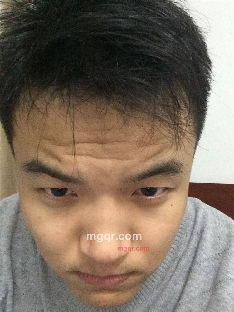 蛋蛋的忧伤七的第1张照片